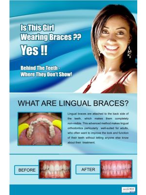 Poster English Orthodontic Lingual Braces - 038